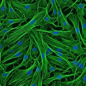 Illustrative render of fibroblast cells, shown as elongated green fibres with blue nuclei